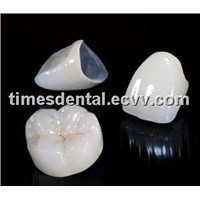 Dental Ceramic Fused to Metal Crown/Bridge
