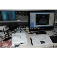 BOX Ultrasound Scanner/Advanced Ultrasound BOX / Magic USG box