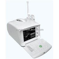 HOT Portable Ultrasound Scanner with CE and ISO