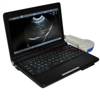 Full Digital Laptop Ultrasound Scanner without Probe (96 element)