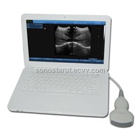 UBook-8 Ultrasound B scanner(Notebook)