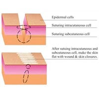 Wound and Skin Closures