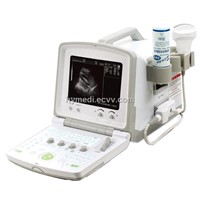 HY-380 Ultrasound Scanner