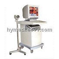 HY-100A Electronic Colposcope