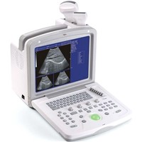 Ultrasound Scanner (HY-180)