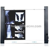 led x ray film viewer 2 sections