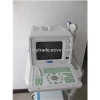 2012 Ultrasound Diagnostic System Portable (DW330)