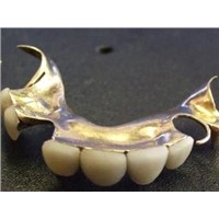 Metal porcelain teeth