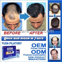 Hair growth spray, stop hair loss in 7 days, hair growth in 15 days, fast effective hair growth