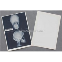 medical dental film dry film, x-ray film