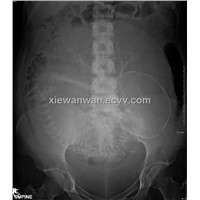medical dry film,medical x ray film,x-ray film,thermal imager