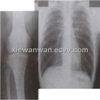 x ray medical image film (XILONG)