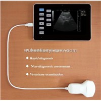 Touchscreen Tablet ultrasound scanner