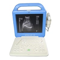CE Approved Digital Laptop Ultrasound Scanner (XK21355LCD)