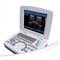 Full digital  laptop ultrasound scanner
