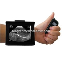 Veterinary Wrist Ultrasound Scanner (KR-8288V)