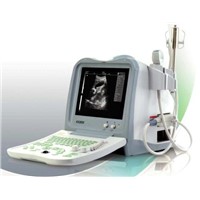 Full Digital b Mode Ultrasound Scanner YSB0102