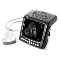 Full Digital Wrist Ultrasound Scanner YSB0105