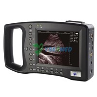 Full Digital Human Ultrasound Scanner (YSB0117)