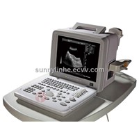 12inch LED Portable Ultrasound Medical Equipments-------Full-digital