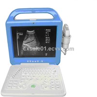 (CX6100C Vet) Laptop Ultrasound Scanner