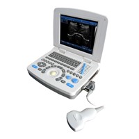 SS-10 Laptop PC Based Ultrasound B Scanner