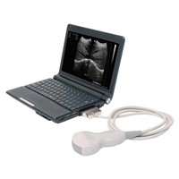 UBook-7 Ultrasound B scanner
