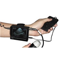 V2 Wrist Ultrasound Scanner