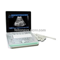 SS-9 PC Based Laptop Ultrasound B scanner(ultrasound,ultrasoni,scanner)
