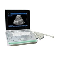 SS-9 PC based Laptop B/W Ultrasound Machine