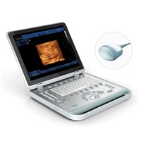 SS-10PLUS Laptop 4D Ultrasoud Scanner