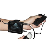 V2 Wrist-wear B/W Ultrasound Scanner