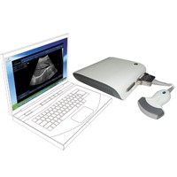 UBox-10 Cost-effective Ultrasound Box