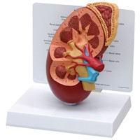 Kidney Model