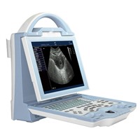 Portable Ultrasound Scanner WHYC40P/Portable machine