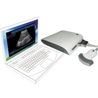 USB ultrasound scanner (provide software)