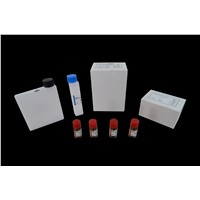 Antistreptolysin O Assay Kit / clinical diagnostic reagent / Immunoturbidimetry method