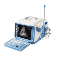 China portable digital ultrasound scanner price