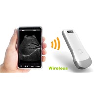 2015 New product wireless ultrasound probe to iphone