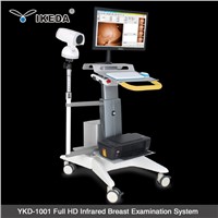 ykd-1001 medical infrafre breast examination equipment