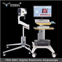 ykd-3001 1080p HD digital video colposcope for vagina