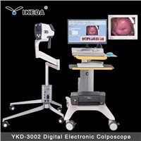 YKD-3002 colposcope camera/vagina colposcope/vagina images pictures