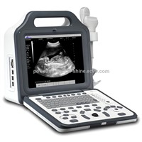 WHYC60P Digital Portable LCD Ultrasound Scanner