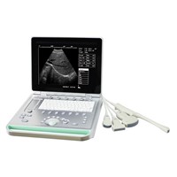 Built-in battery laptop ultrasound scanner for medical use