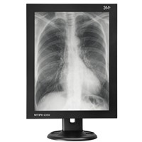 3MP medical monochrome LCD monitors