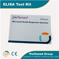 HIV (1+2) Ag/Ab ELISA test kit