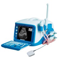 SH-1000 portable ultrasound scanner