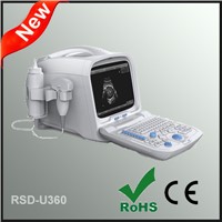 2015 CE Approved Laptop Ultrasonic Diagnostic Scanner