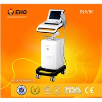 Face lifting wrinklr remover high intensity focoused ultrasound machine