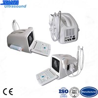 CE Approved Portable B-Mode Ultrasound Scanner with 3.5MHz Convex Probe